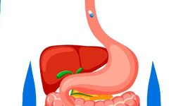 capsulas_endoscopicas